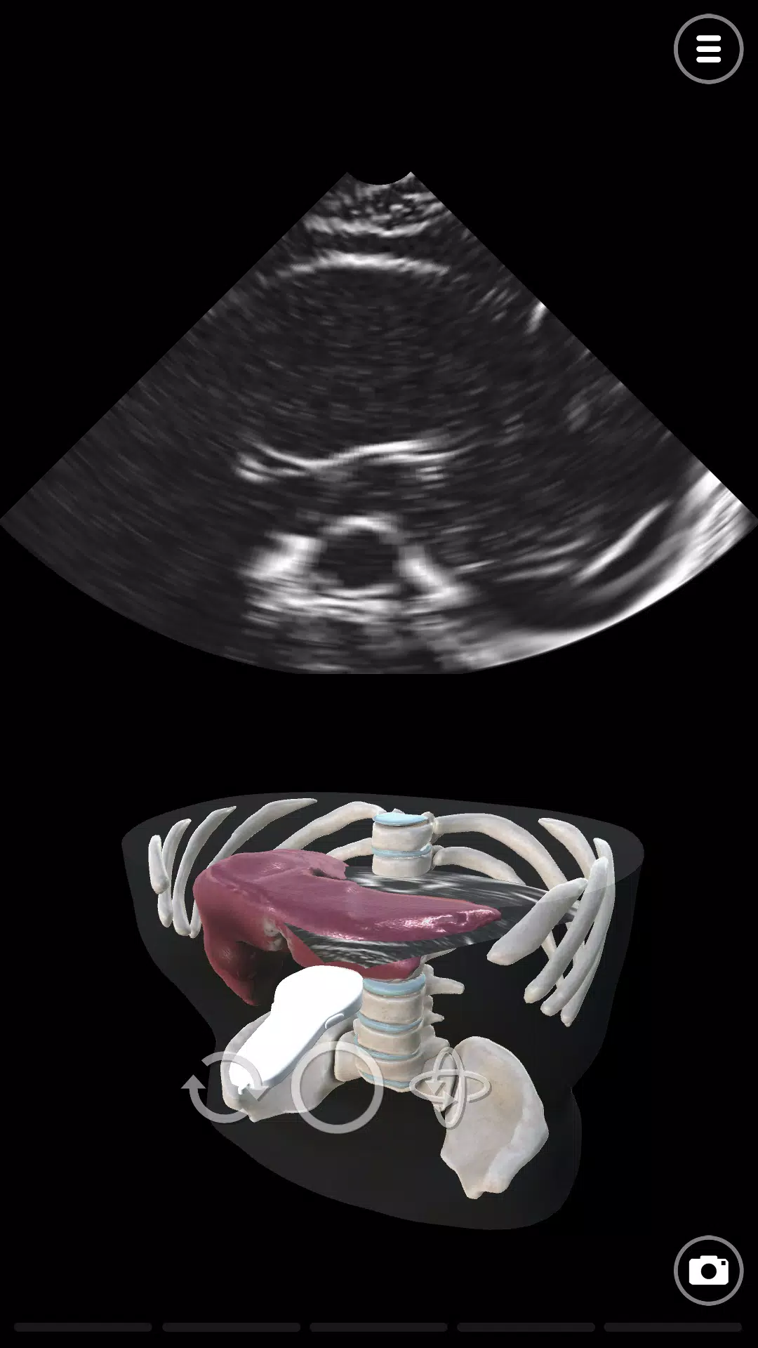 Deepscope Ultrasound Simulator ဖန်သားပြင်ဓာတ်ပုံ 1