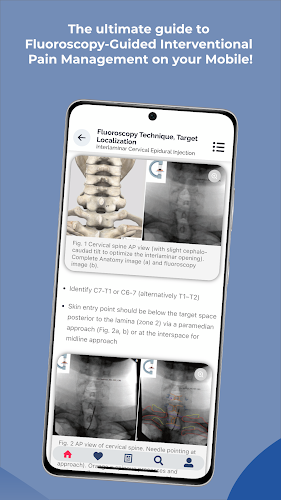 Interventional Pain App スクリーンショット 3