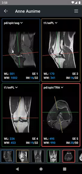 IDV - IMAIOS DICOM Viewer Screenshot 2