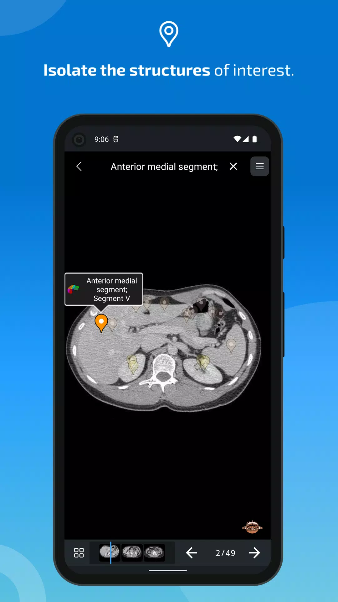 e-Anatomy Screenshot 3