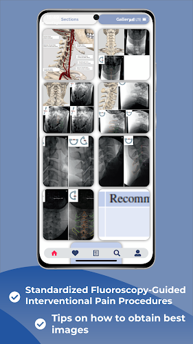 Interventional Pain App スクリーンショット 2