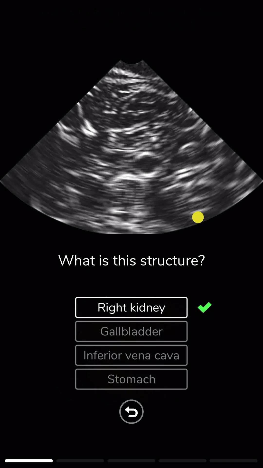 Deepscope Ultrasound Simulator ဖန်သားပြင်ဓာတ်ပုံ 3